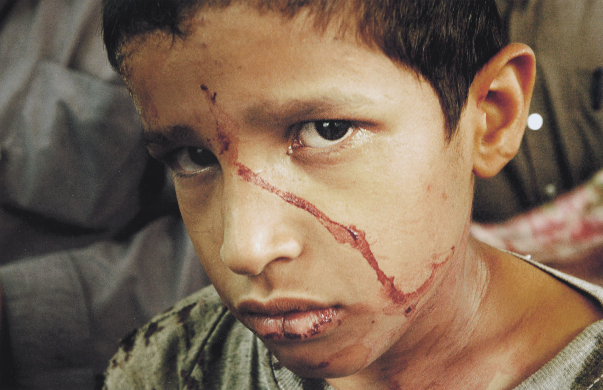 Bloodied Boy Sadr City